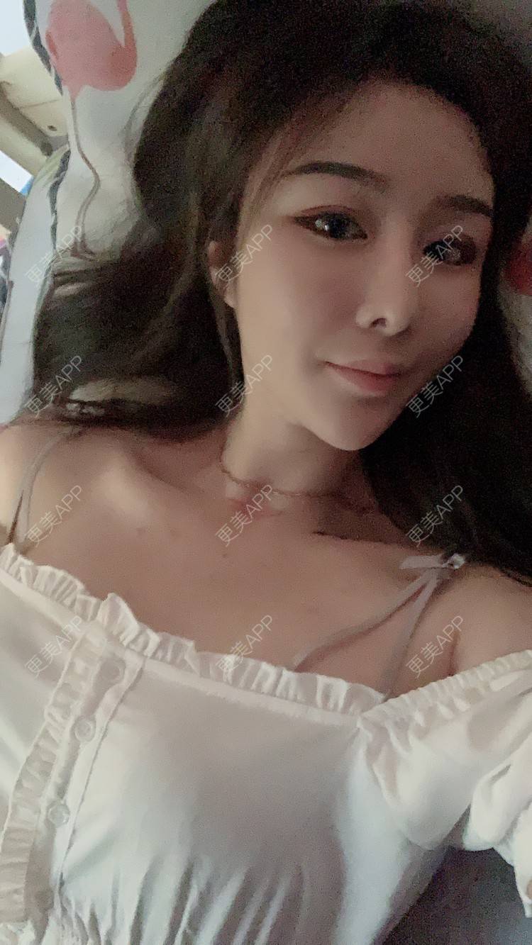 更美 - 呐呐😁的隆鼻经验 | 北京 | 视频日记 | 隆鼻