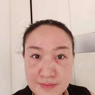 更美用户Z28pYLcJqq