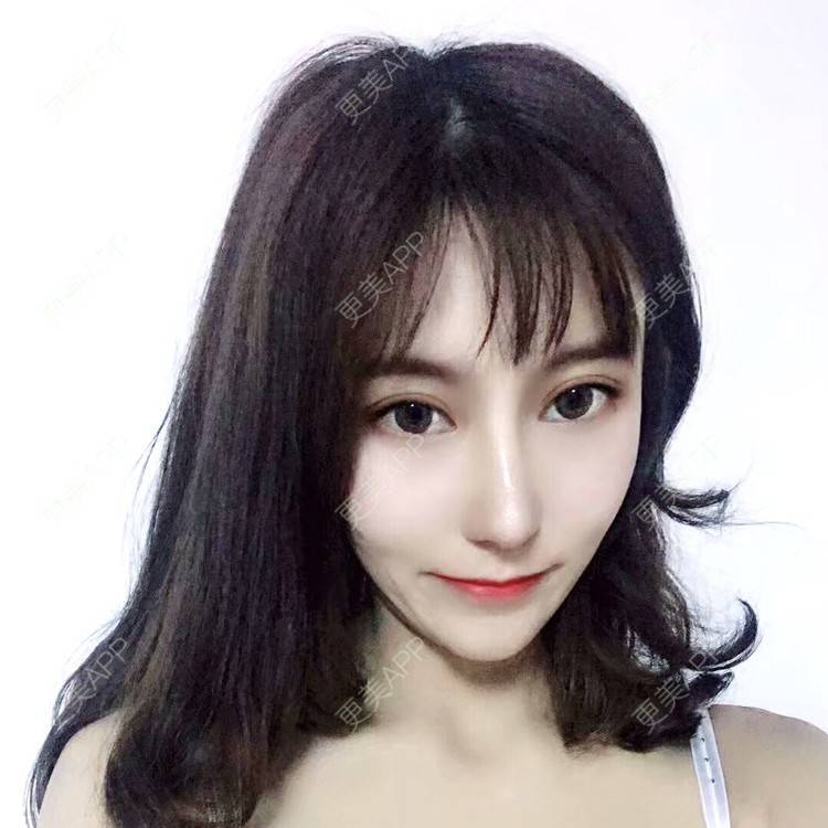 更美 - 不曾难过的鼻部多项经验 | 杭州 | 视频日记 | 鼻部多项