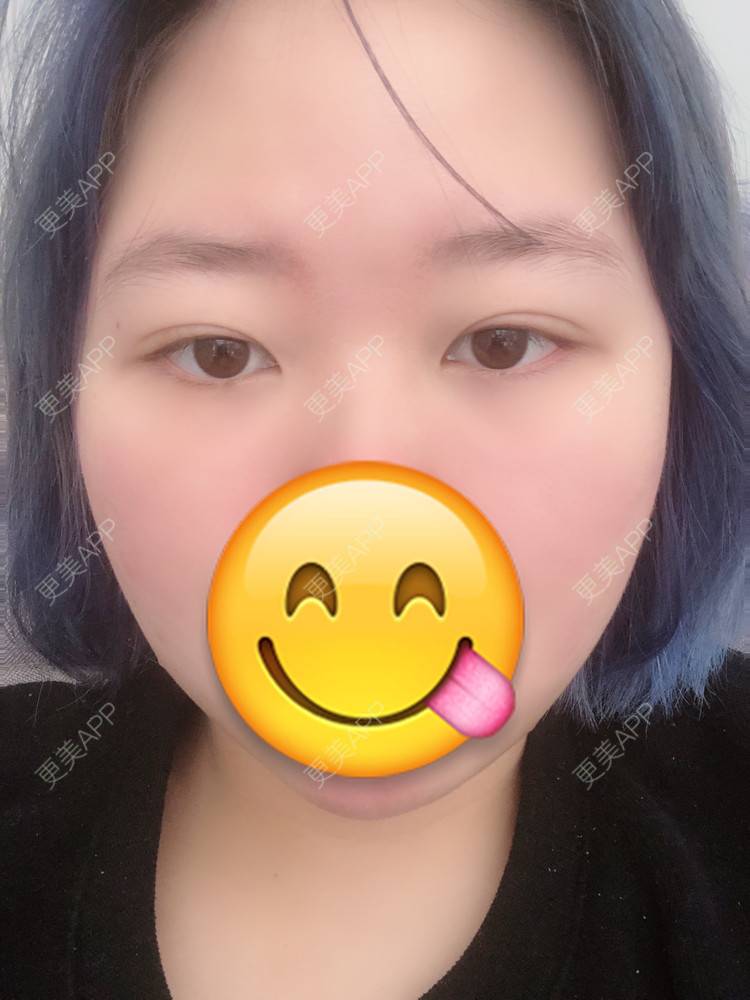 更美 - 更美用户IjMiunIpAy的眼部多项经验 | 眼部多项 | 长沙