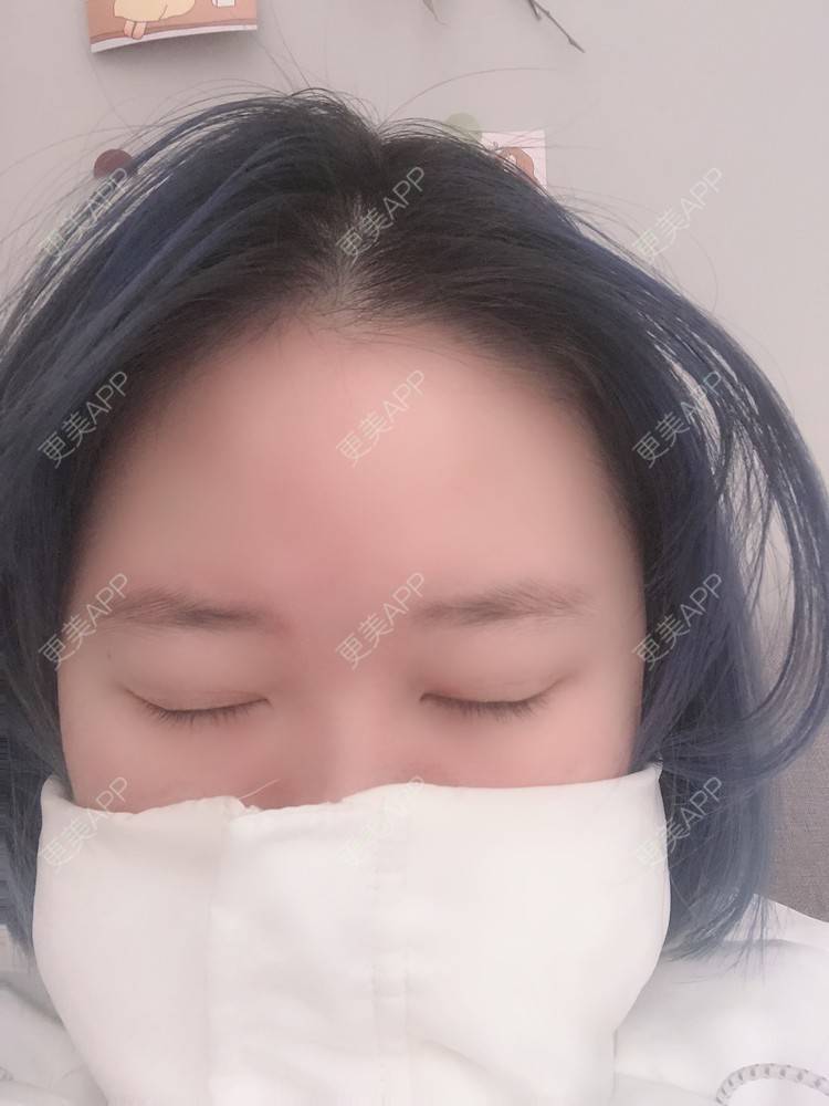 更美 - 更美用户IjMiunIpAy的眼部多项经验 | 眼部多项 | 长沙
