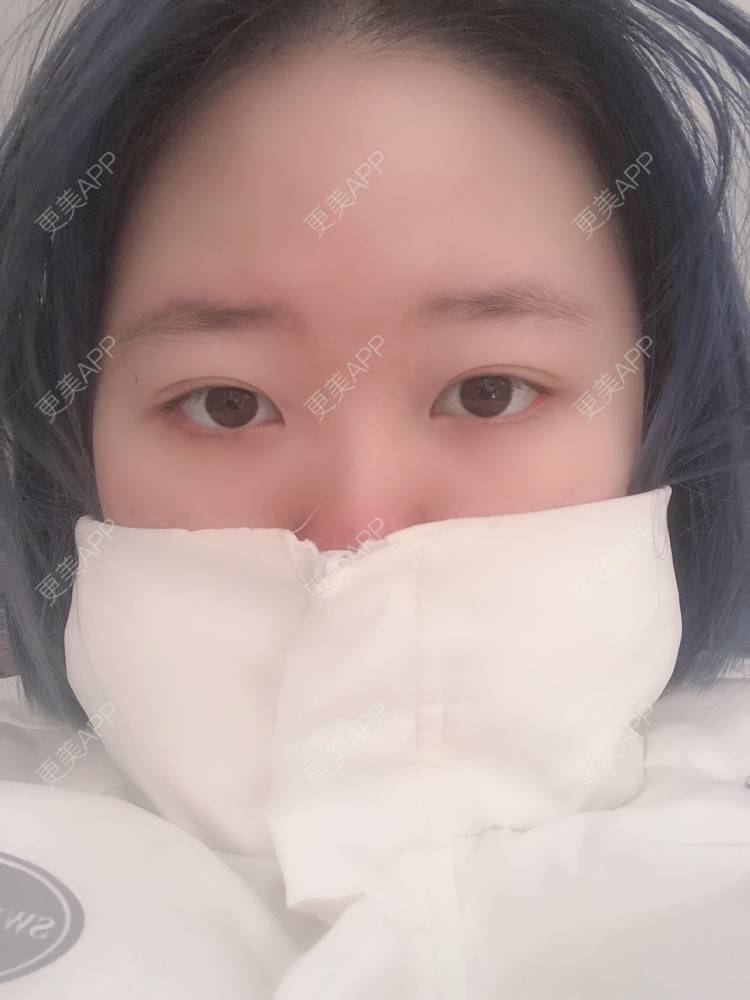 更美 - 更美用户IjMiunIpAy的眼部多项经验 | 眼部多项 | 长沙