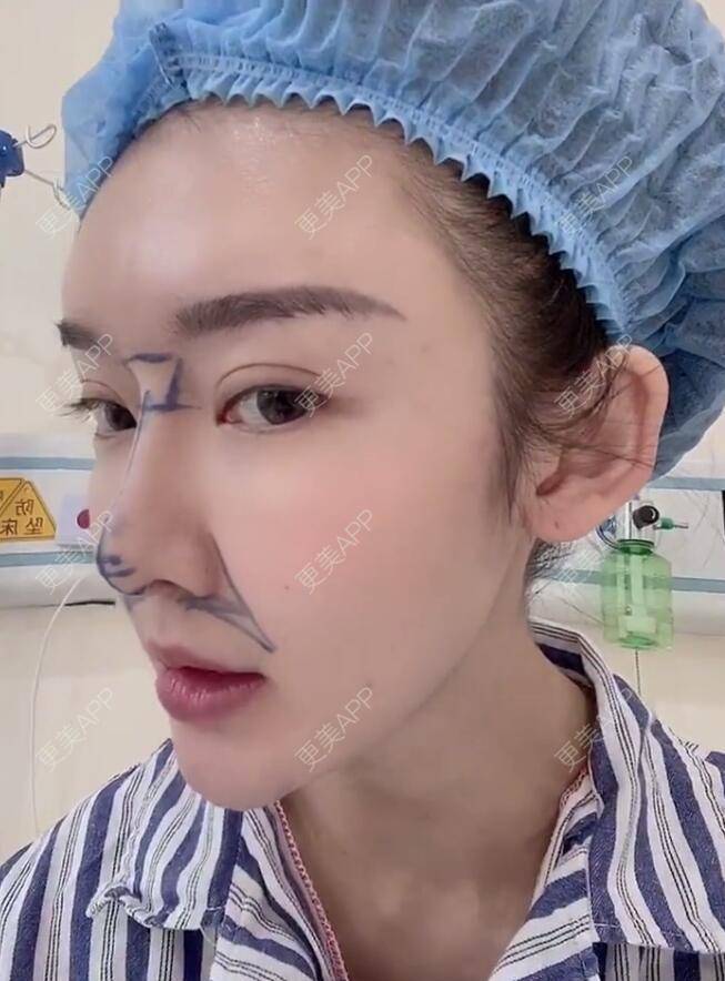 更美 - 分分秒秒拼的鼻部多项经验 | 鼻部多项 | 厦门