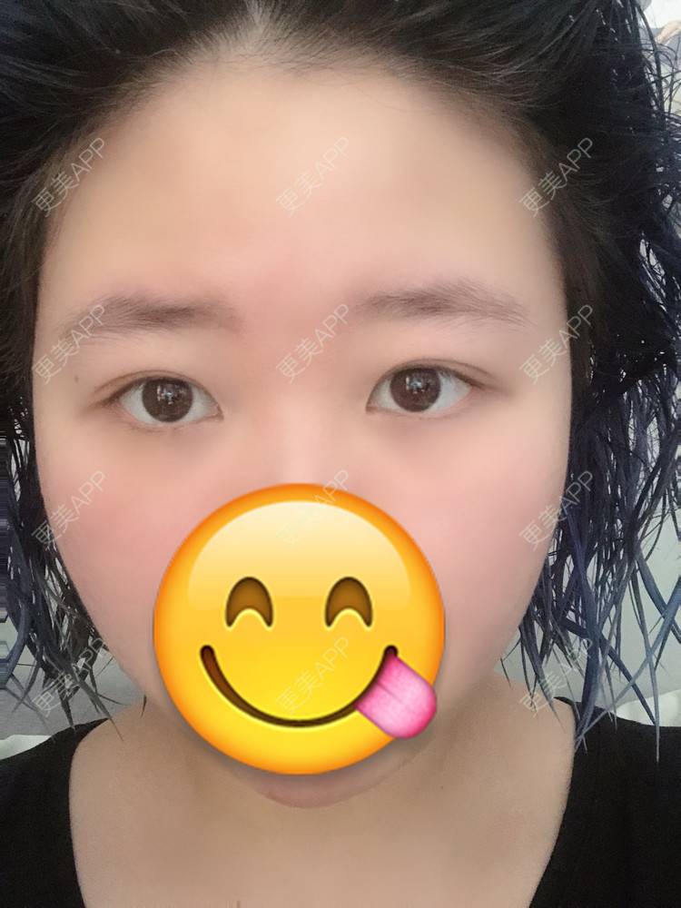 更美 - 更美用户IjMiunIpAy的眼部多项经验 | 眼部多项 | 长沙