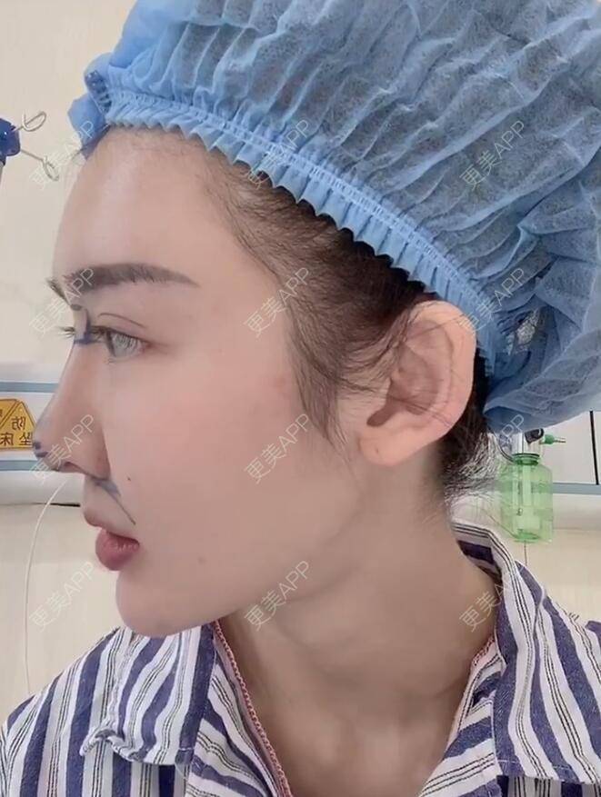 更美 - 分分秒秒拼的鼻部多项经验 | 鼻部多项 | 厦门