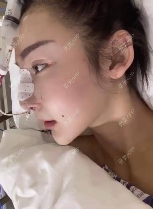更美 - 分分秒秒拼的鼻部多项经验 | 鼻部多项 | 厦门