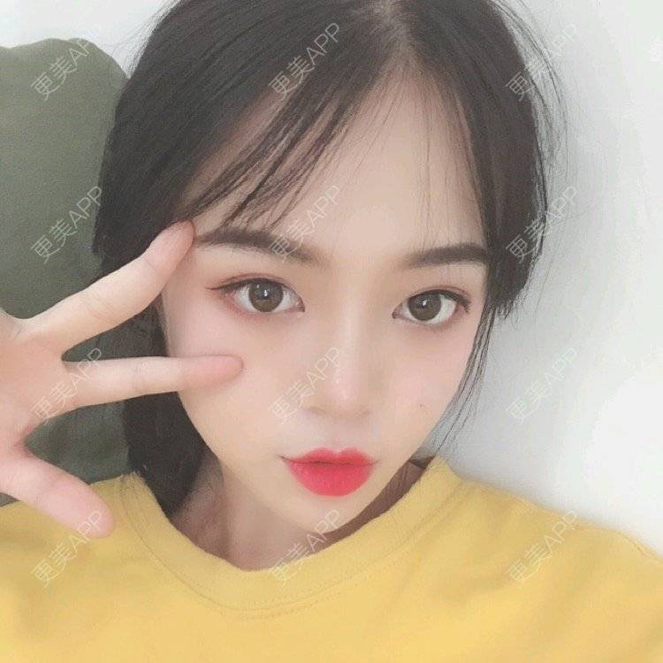 更美 - 更美用户36jxnTN8Yj的厚唇改薄经验 | 厚唇改薄 | 上海