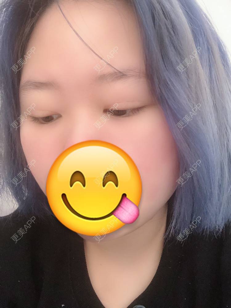 更美 - 更美用户IjMiunIpAy的眼部多项经验 | 眼部多项 | 长沙