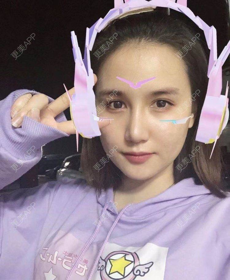 更美 - 妍👀小的膨体隆鼻经验 | 膨体隆鼻 | 肋软骨隆鼻 | 鼻翼缩小