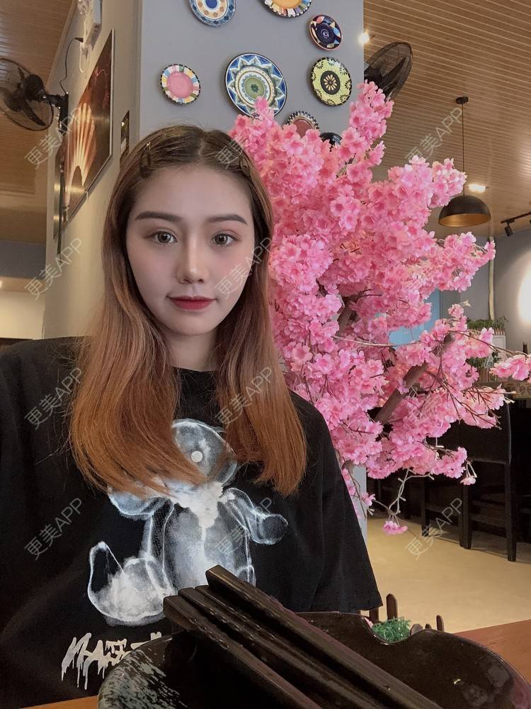 更美 - 更美用户DmEbgEZQGf的硅胶隆鼻经验 | 硅胶隆鼻 | 广州 | 视频日记