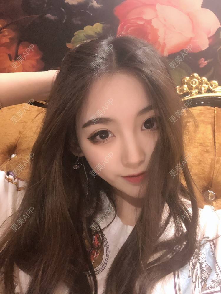 更美 - 更美用户OIUGSDAsJ5的双眼皮经验 | 成都 | 视频日记 | 双眼皮
