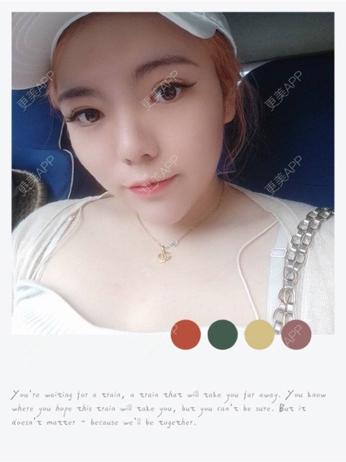更美 - 更美用户Igf0wueJ8d的果酸焕肤经验 | 上海 | 果酸焕肤
