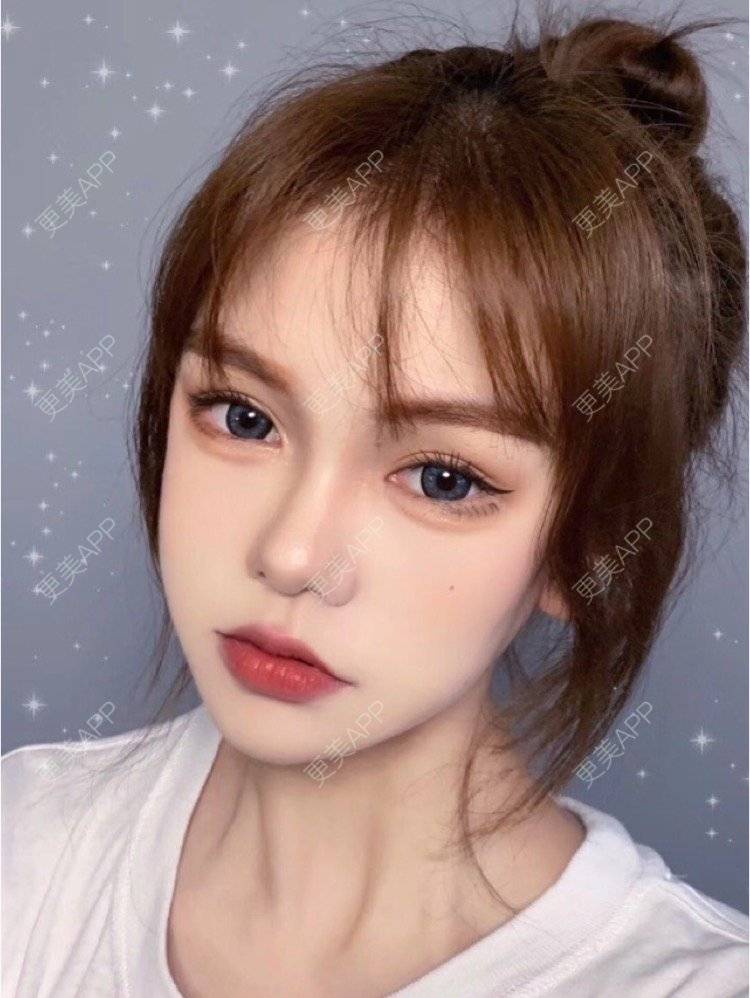 更美 - 更美用户Igf0wueJ8d的点阵激光经验 | 上海 | 点阵激光