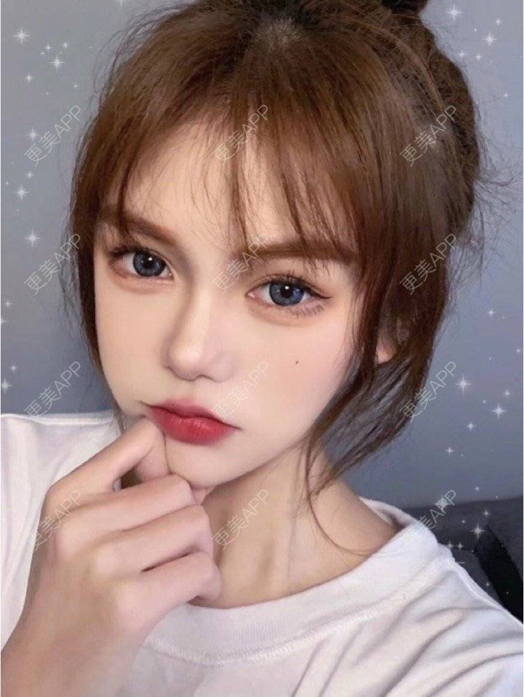 更美 - 更美用户Igf0wueJ8d的点阵激光经验 | 上海 | 点阵激光
