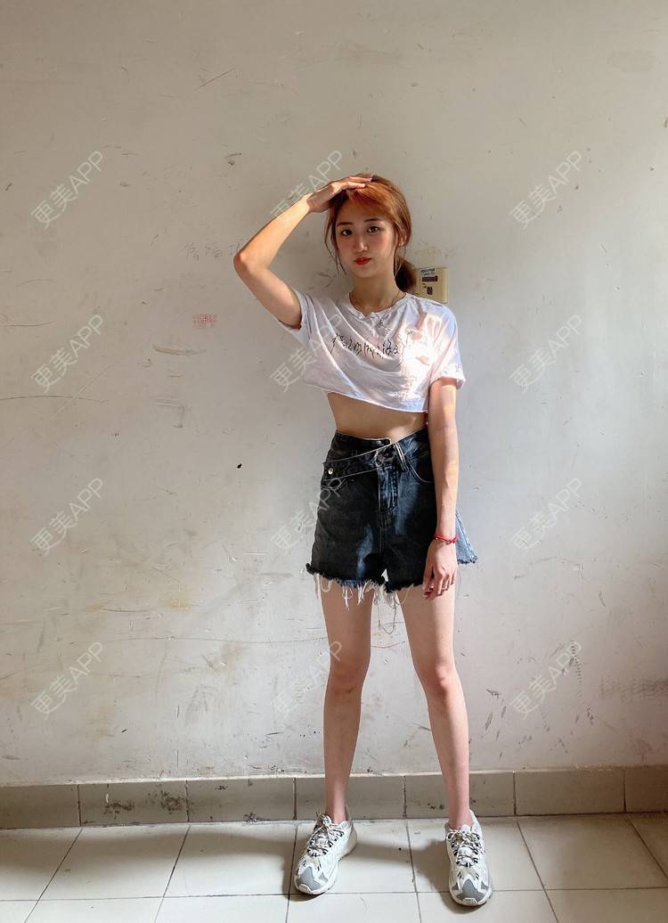 更美 - 更美用户8cJfwtNDeD的腹部吸脂经验 | 腹部吸脂