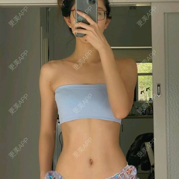 更美 - 更美用户TsMkuS7EUU的吸脂瘦脸经验 | 吸脂瘦脸 | 杭州