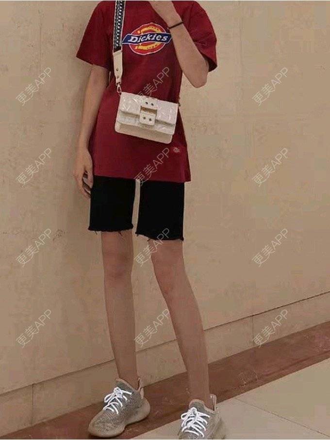 更美 - 更美用户Igf0wueJ8d的腰部吸脂经验 | 上海 | 腰部吸脂