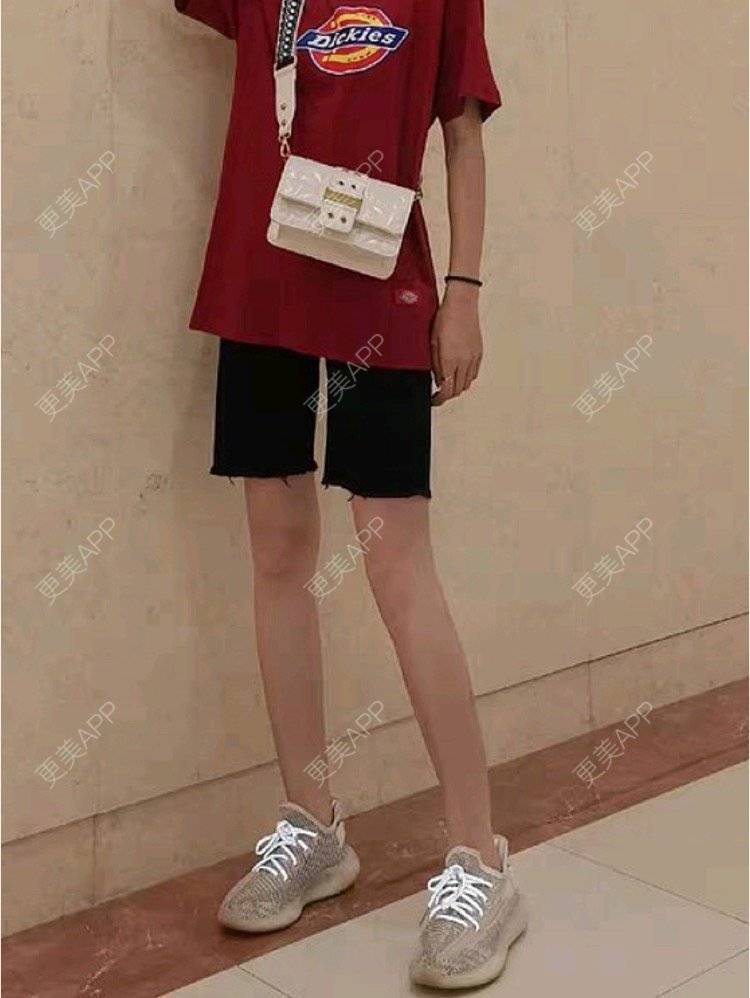 更美 - 更美用户Igf0wueJ8d的腰部吸脂经验 | 上海 | 腰部吸脂