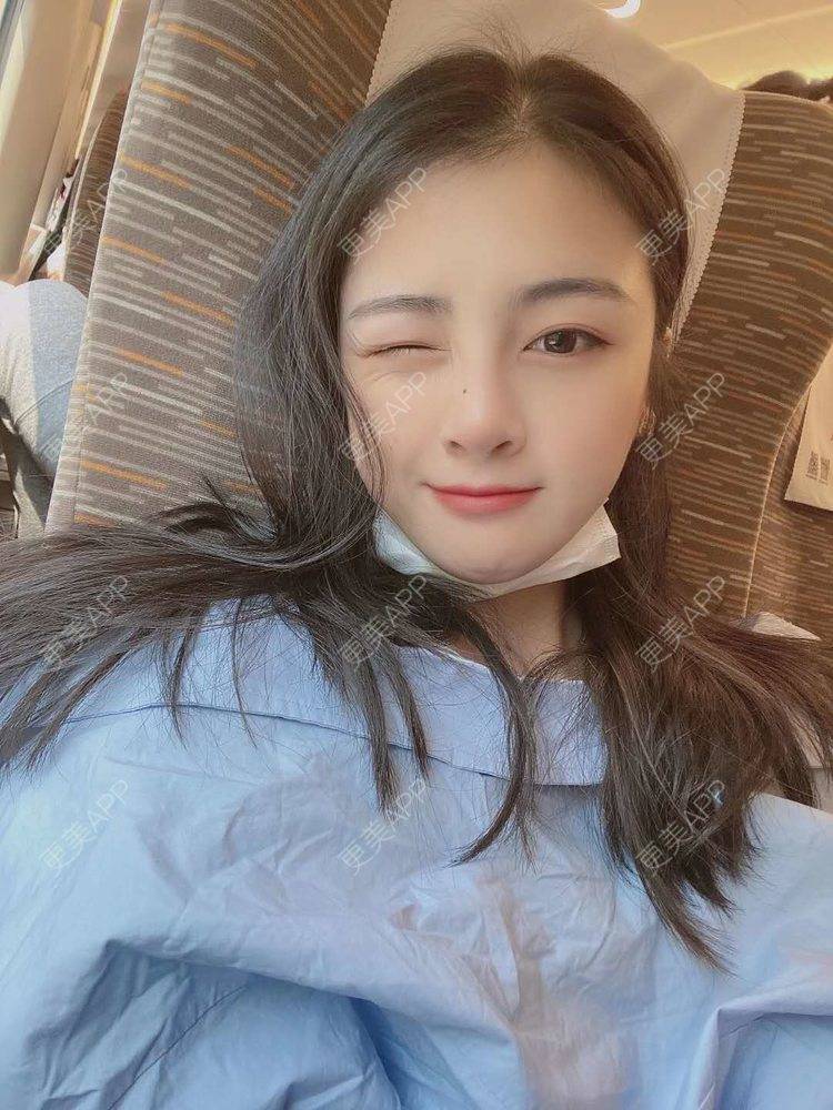 更美 - 更美用户riiy1Ld8RJ的鼻部综合经验 | 视频日记 | 深圳 | 鼻部综合