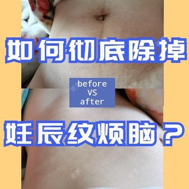 桦桦子