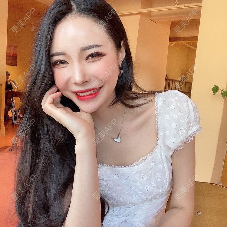 更美 - 更美用户SwSxuq3HzG的冷光美白经验 | 冷光美白