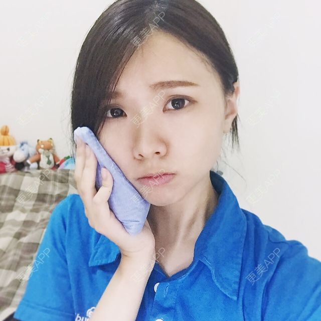 更美 - 更美用户dFn65dQfvj的牙齿矫正经验 | 牙齿矫正