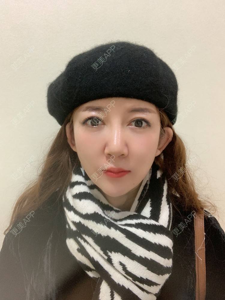 更美 - 更美用户d9qyRgUnbM的光子嫩肤经验 | 光子嫩肤 | 北京