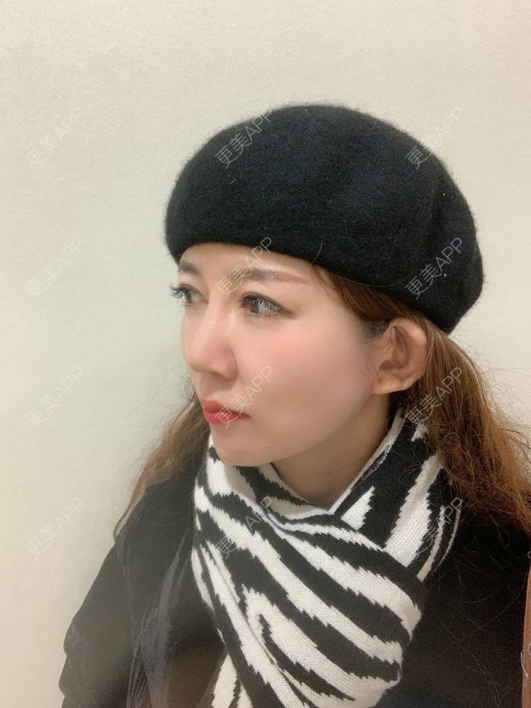 更美 - 更美用户d9qyRgUnbM的光子嫩肤经验 | 光子嫩肤 | 北京
