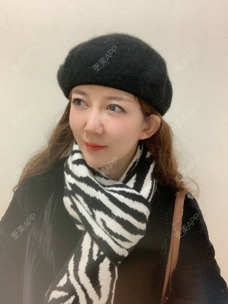 更美 - 更美用户d9qyRgUnbM的光子嫩肤经验 | 光子嫩肤 | 北京