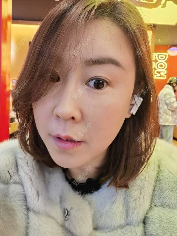 更美 - 更美用户JQiKDssKbO的玻尿酸颈纹经验 | 玻尿酸颈纹 | 重庆