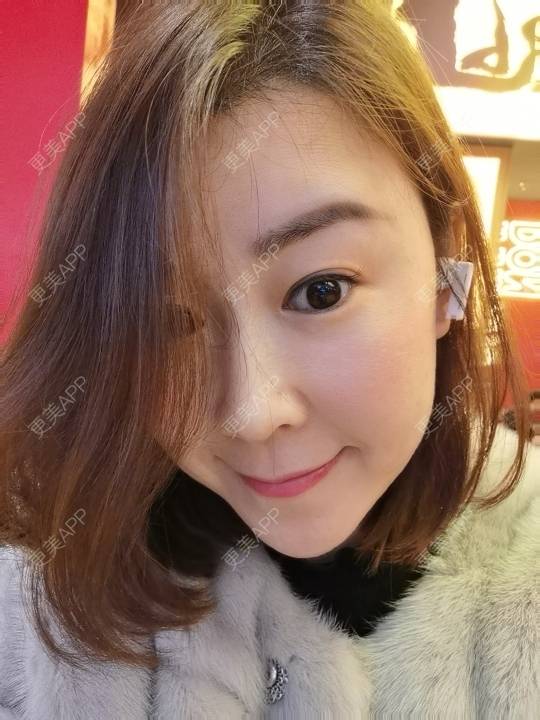 更美 - 更美用户JQiKDssKbO的玻尿酸颈纹经验 | 玻尿酸颈纹 | 重庆