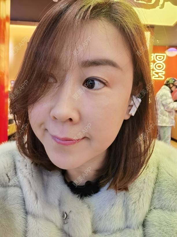 更美 - 更美用户JQiKDssKbO的玻尿酸颈纹经验 | 玻尿酸颈纹 | 重庆