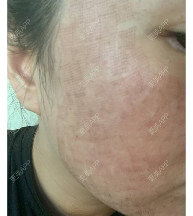 更美用户cdbpp34bta的点阵激光日记