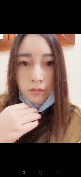 更美 - 更美用户35W00VbmuW的除皱瘦脸经验 | 除皱瘦脸 | 成都