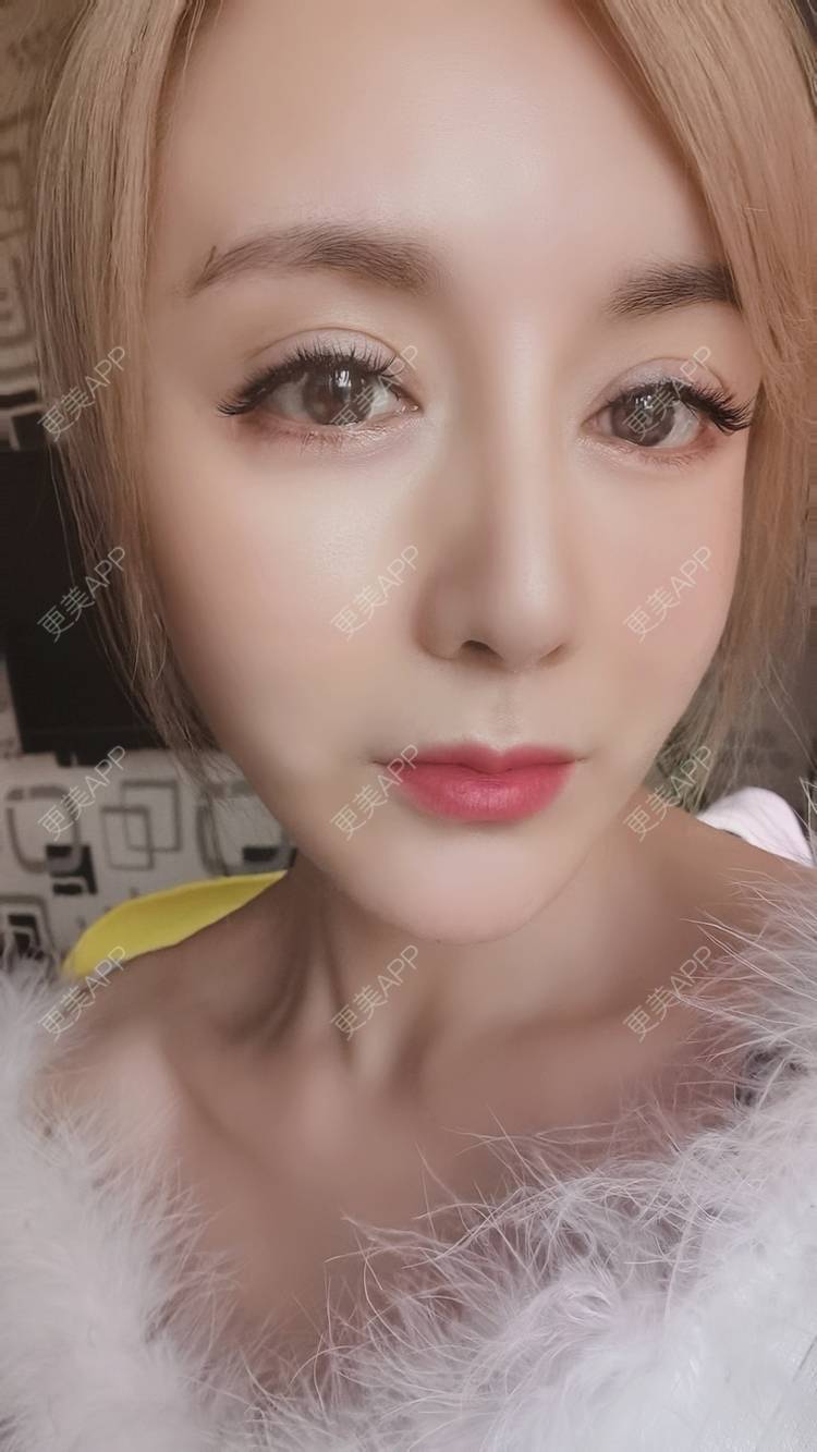 木木1314520的全脸整形套餐日记