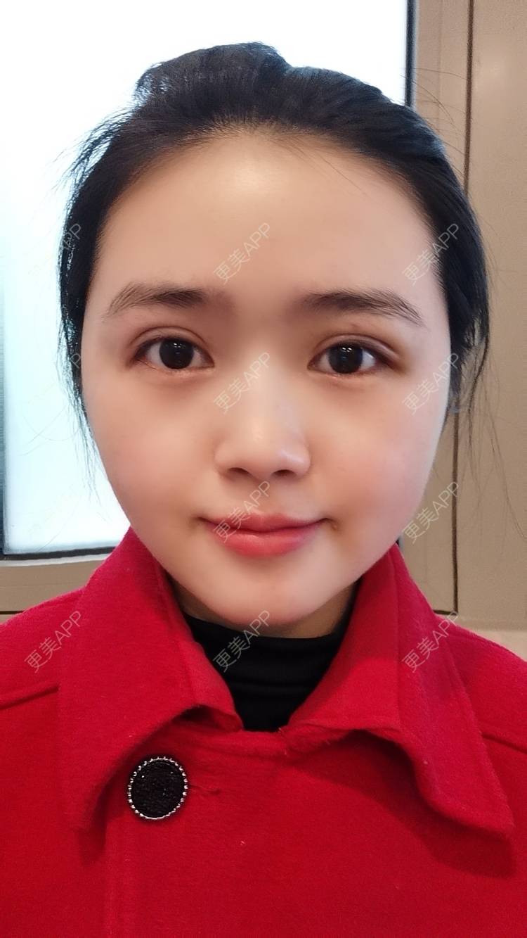 茫的全切双眼皮日记