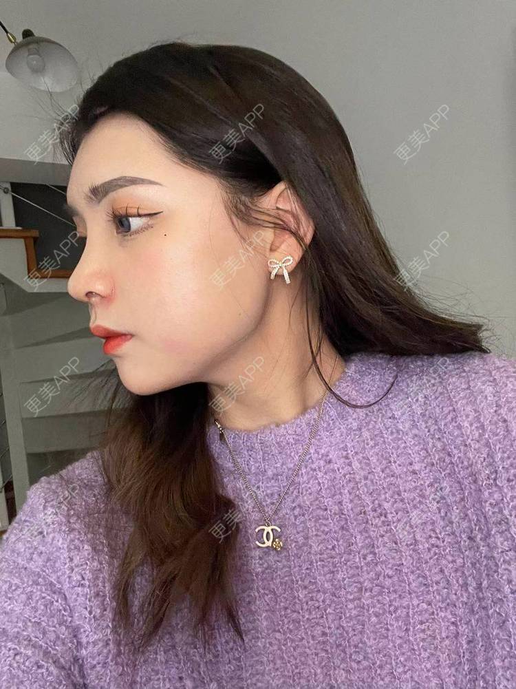 春风樱飘的肋软骨隆鼻日记