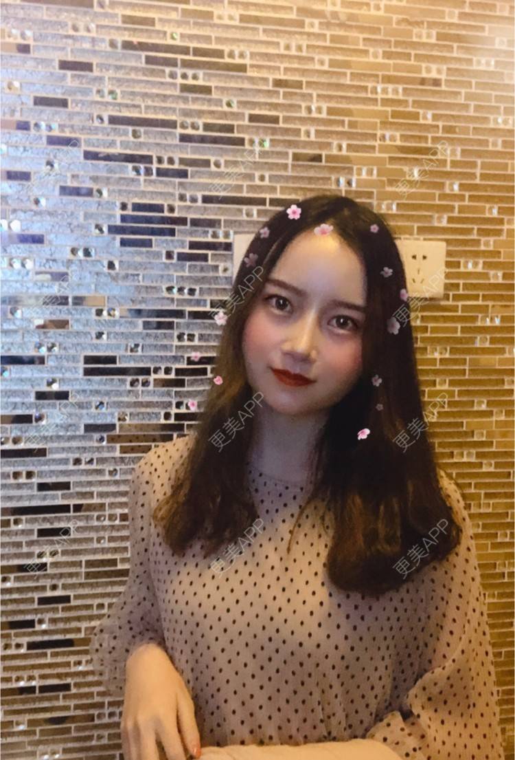 更美 - 严广的超声波洗牙经验 | 武汉 | 树脂补牙