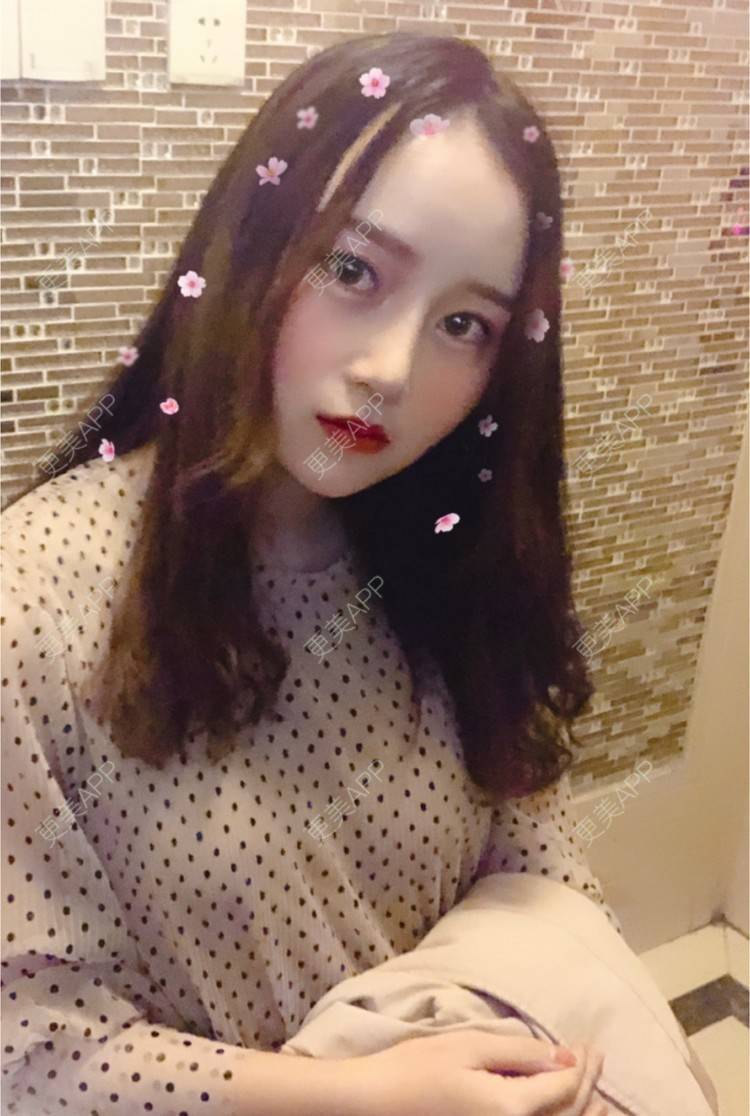更美 - 严广的超声波洗牙经验 | 武汉 | 树脂补牙