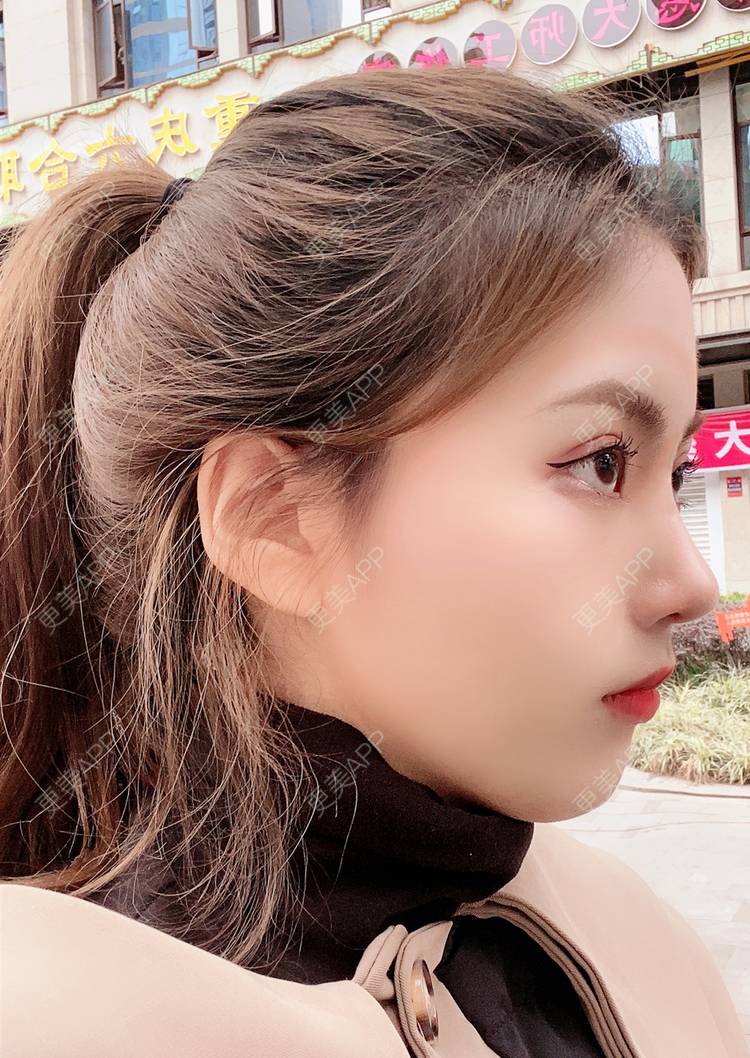 玫瑰橡的鼻综合日记