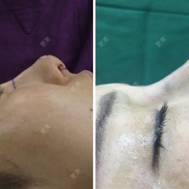 深圳鹏爱医疗美容医院