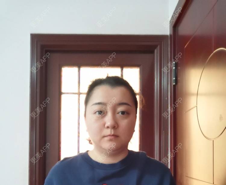 更美 - 更美用户ID74FSnd7S的颈部经验 | 热玛吉 | 颈部 | 除皱 | 重庆 | 超声提升 | 埋线除皱 | 射频提升 | 热拉提 | 肤质检测 | 皮肤综合管理套餐 | 除皱套餐