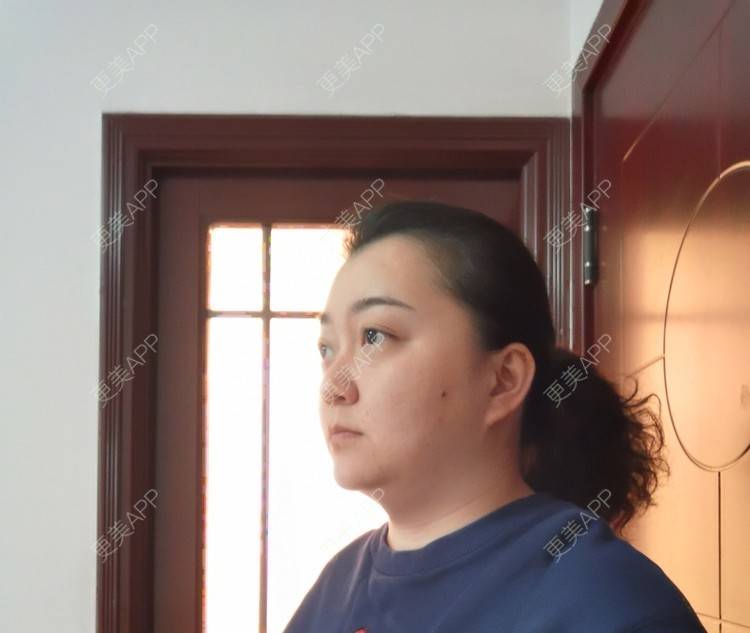 更美 - 更美用户ID74FSnd7S的颈部经验 | 热玛吉 | 颈部 | 除皱 | 重庆 | 超声提升 | 埋线除皱 | 射频提升 | 热拉提 | 肤质检测 | 皮肤综合管理套餐 | 除皱套餐