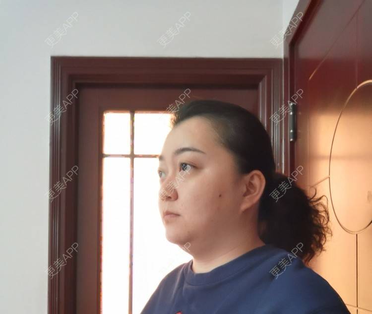 更美 - 更美用户ID74FSnd7S的颈部经验 | 热玛吉 | 颈部 | 除皱 | 重庆 | 超声提升 | 埋线除皱 | 射频提升 | 热拉提 | 肤质检测 | 皮肤综合管理套餐 | 除皱套餐