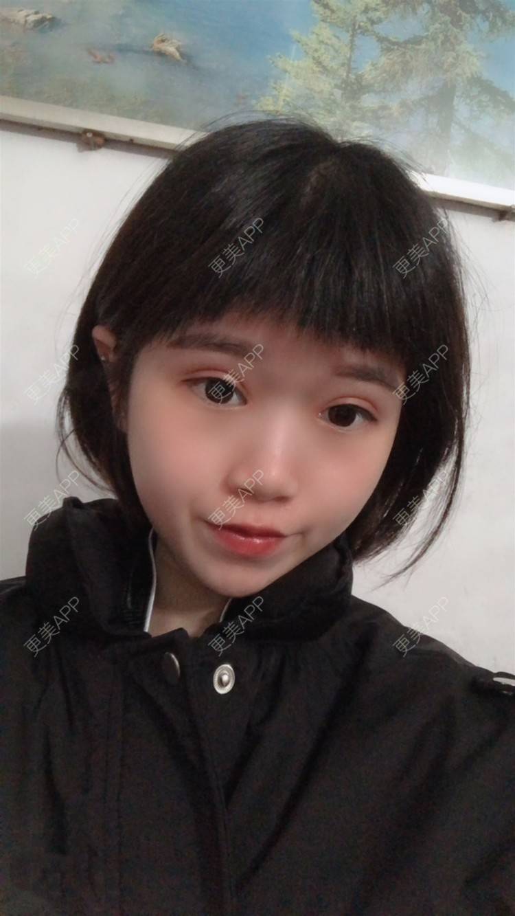 更美用户cxzrpsbets的全切双眼皮日记