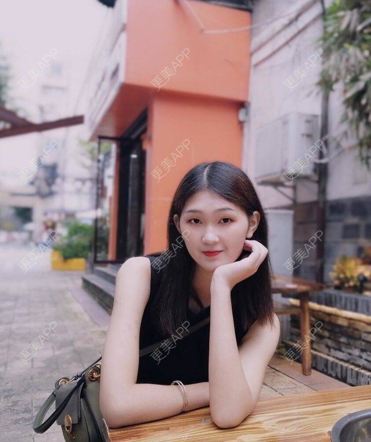 更美 - 更美用户1K5PvWVJBD的激光淡疤经验 | 激光淡疤 | 成都