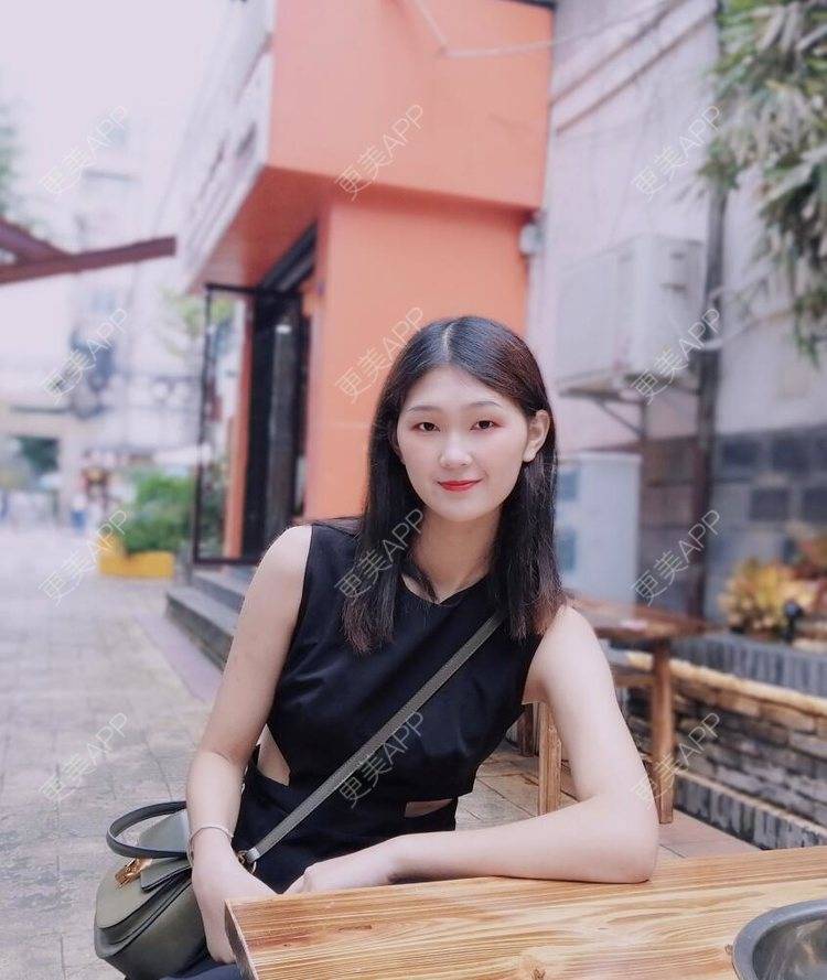 更美 - 更美用户1K5PvWVJBD的激光淡疤经验 | 激光淡疤 | 成都