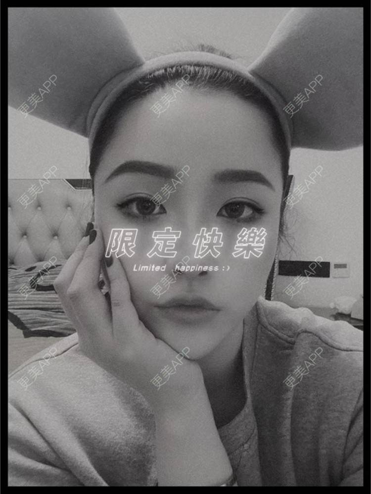 更美 - 努力变美123123的除皱瘦脸经验 | 除皱瘦脸 | 苏州