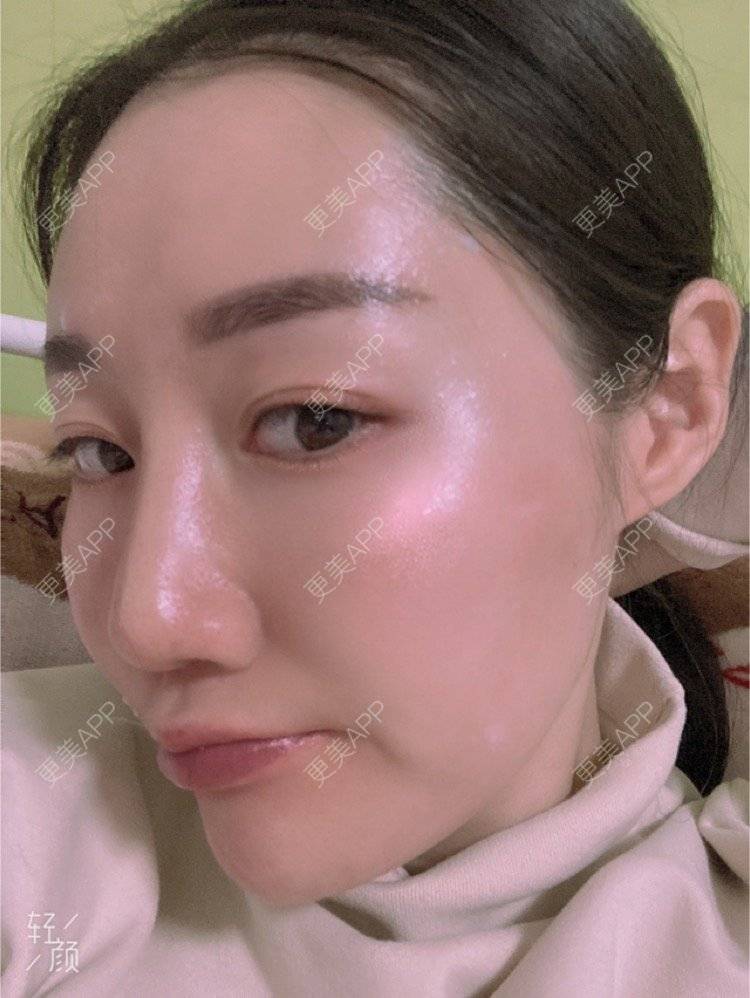 更美 - 更美用户KypVf5ovVE的经验 | 上海