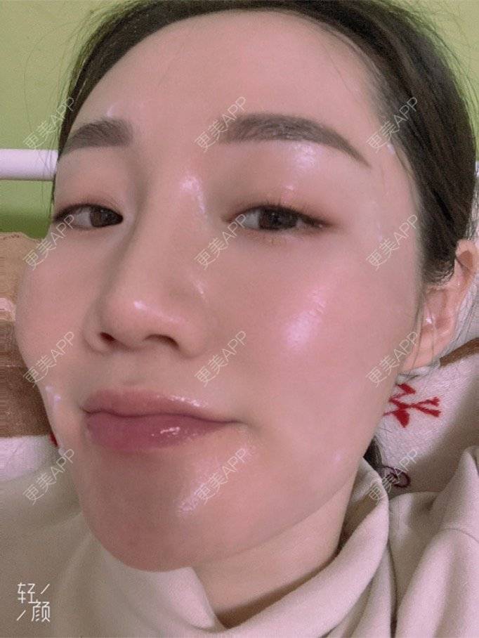 更美 - 更美用户KypVf5ovVE的经验 | 上海